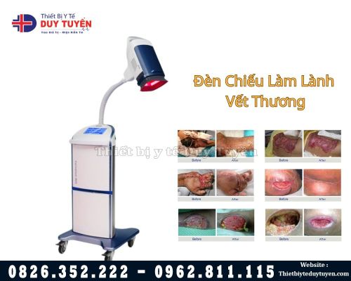 Đèn chiếu làm lành vết thương hở 86S