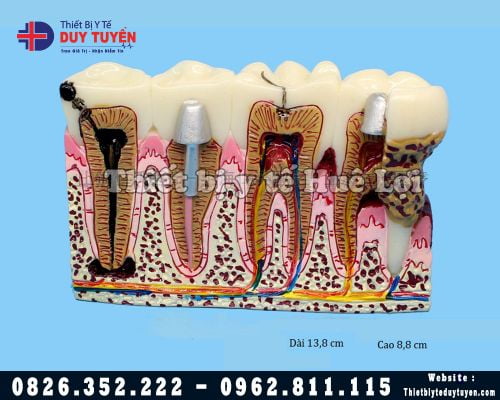 Mô hình răng nội nha