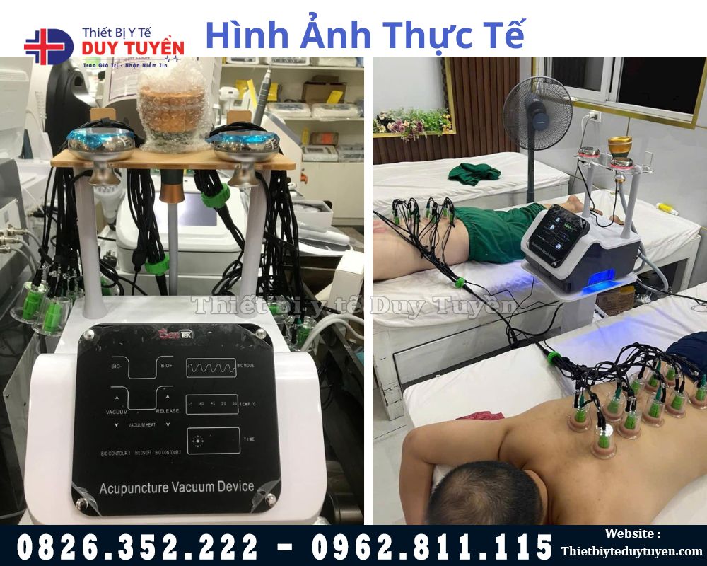 máy điện di kèm giác hơi 3 trong 1