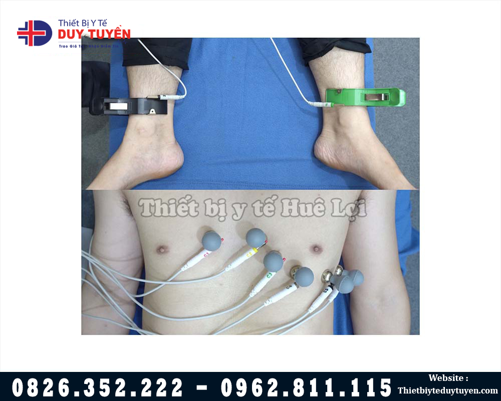 sử dụng máy điện tim 300G