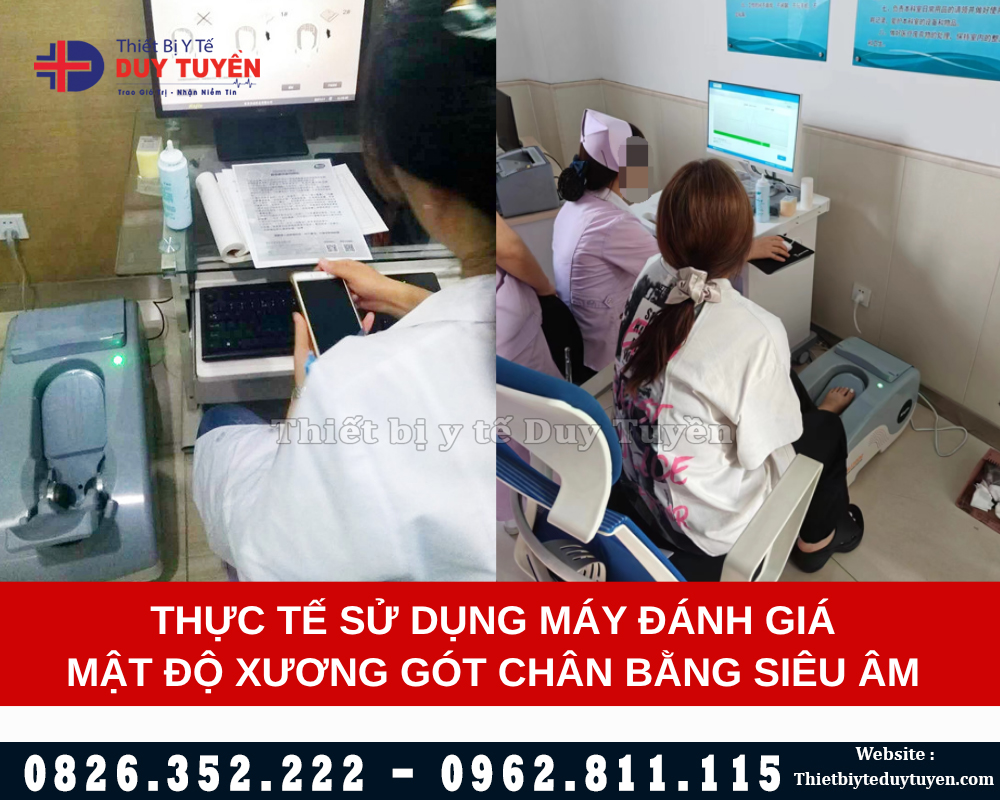 kiểm tra loãng xương bằng máy OSTEOKJ3000