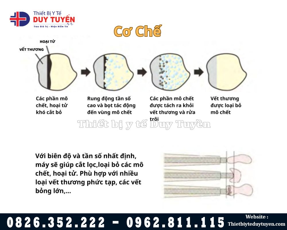 cơ chế hoạt động máy cắt vết thương