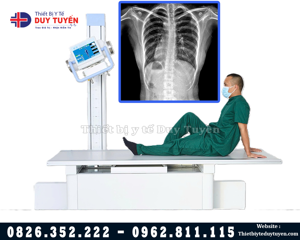 Chụp X Quang Kỹ Thuật Số