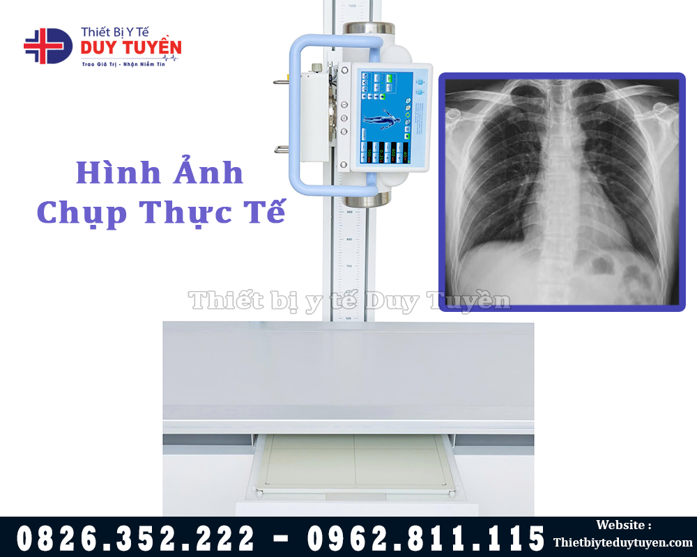 Máy Chụp X Quang Giá Rẻ