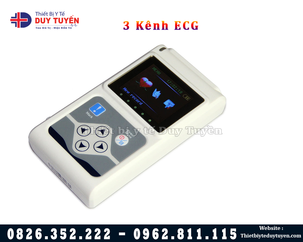 Holter điện tim theo dõi 24 giờ