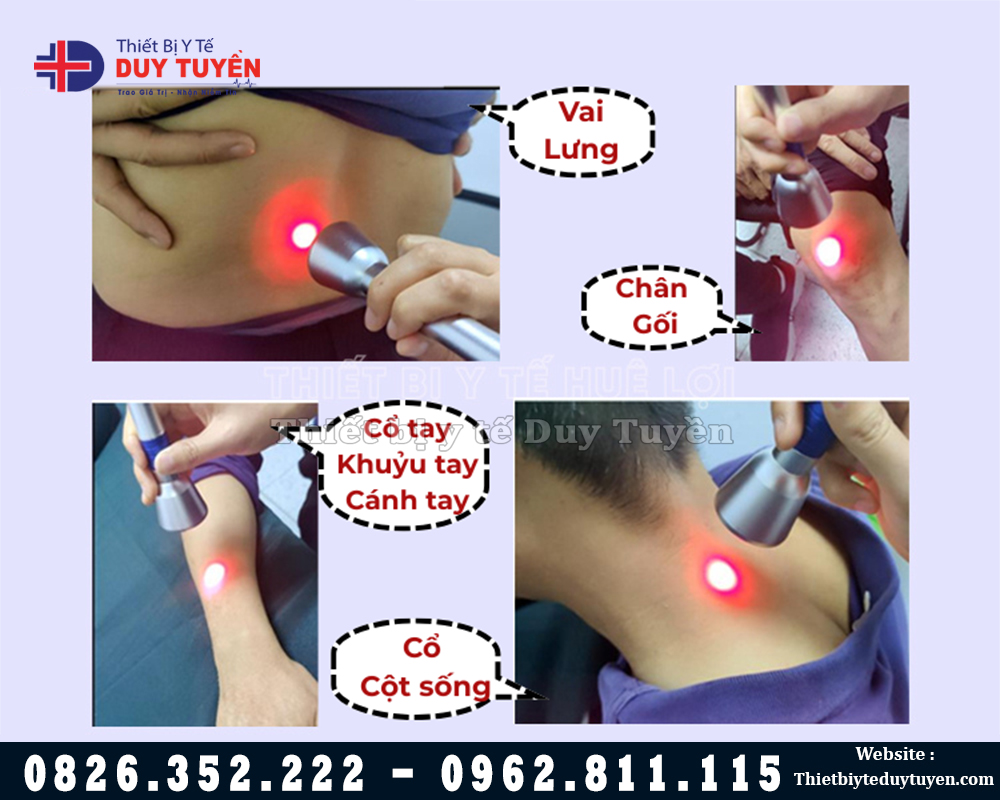 máy trị liệu sóng laser