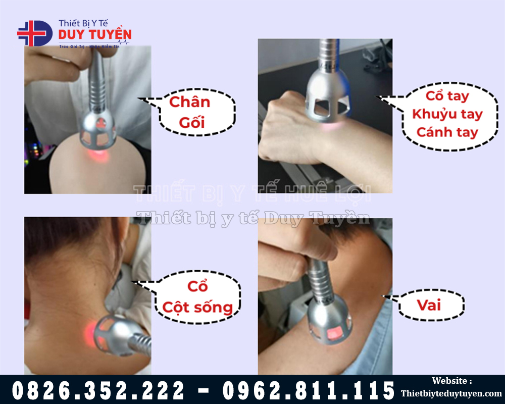 sóng laser trị liệu công suất lớn