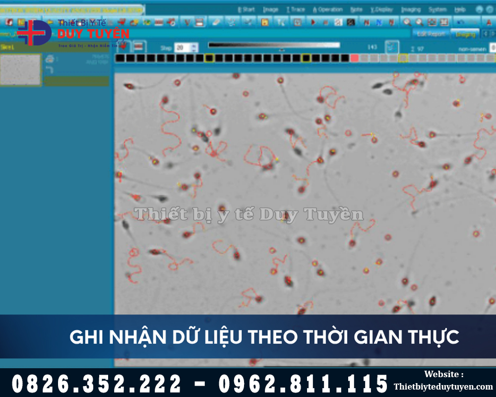 đo mật độ và di chuyển tinh trùng