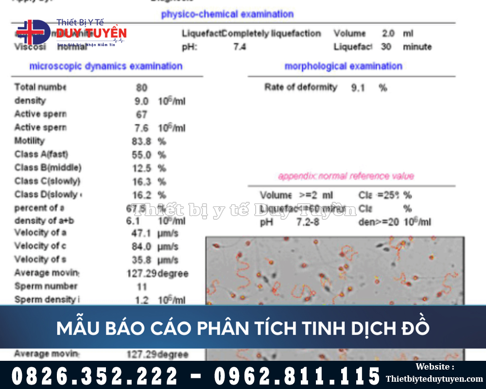 kết quả phân tích tinh dịch