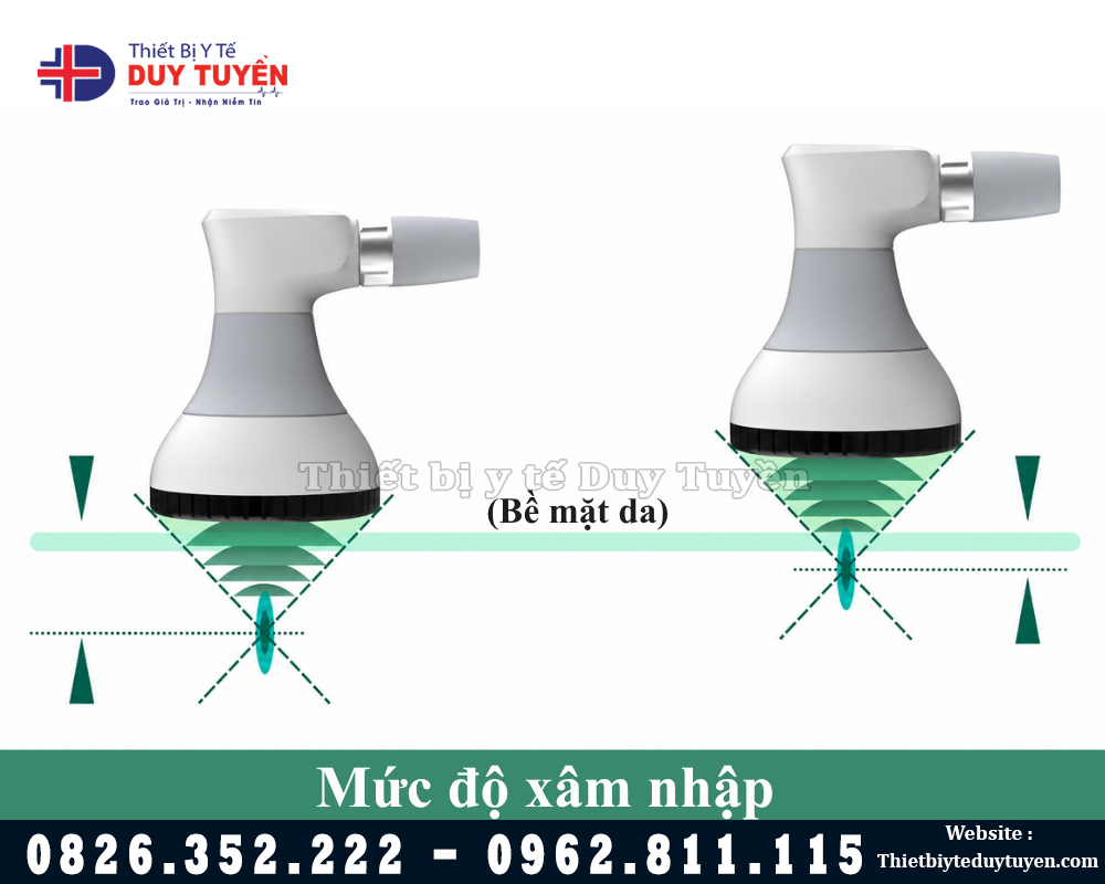 đầu dò máy xung kích hội tụ áp điện công nghệ mới