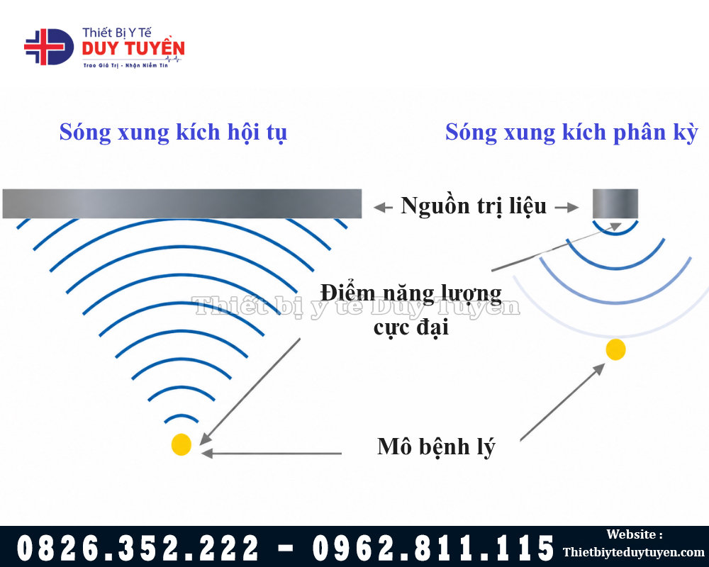 xung kích hội tụ khác phân kì như nào