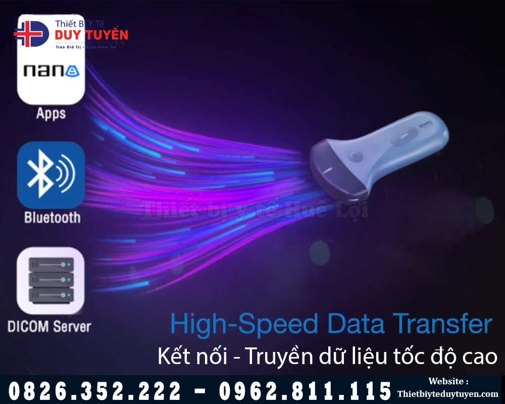 công nghệ mới máy siêu âm cầm tay EDAN