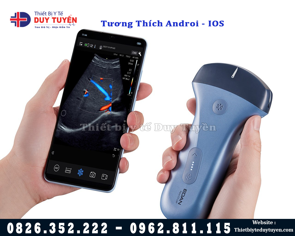 máy siêu âm cầm tay kết nối điện thoại