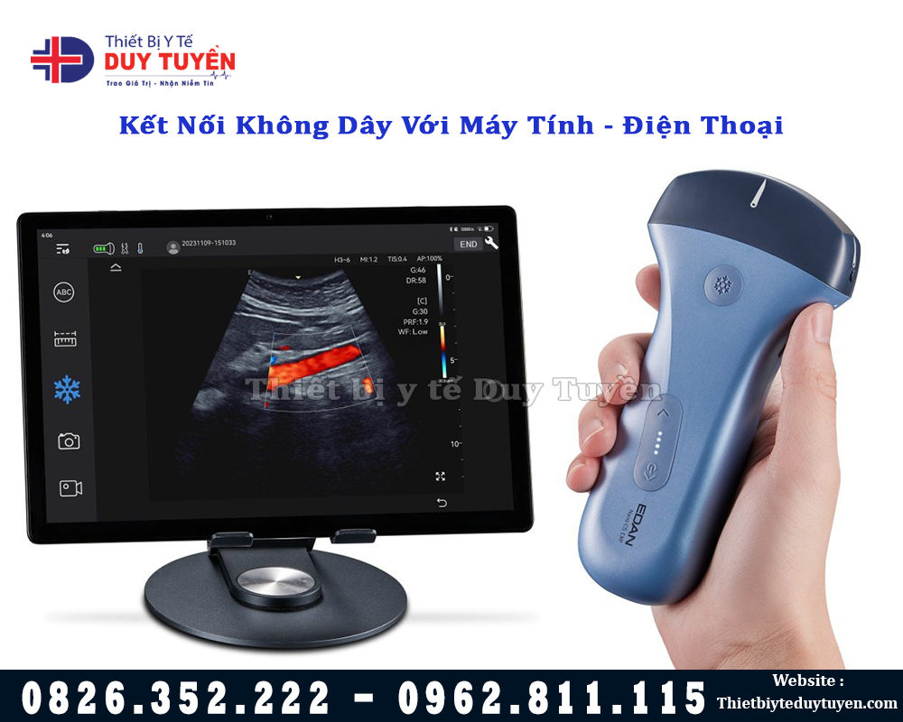 máy siêu âm mini kết nối máy tính