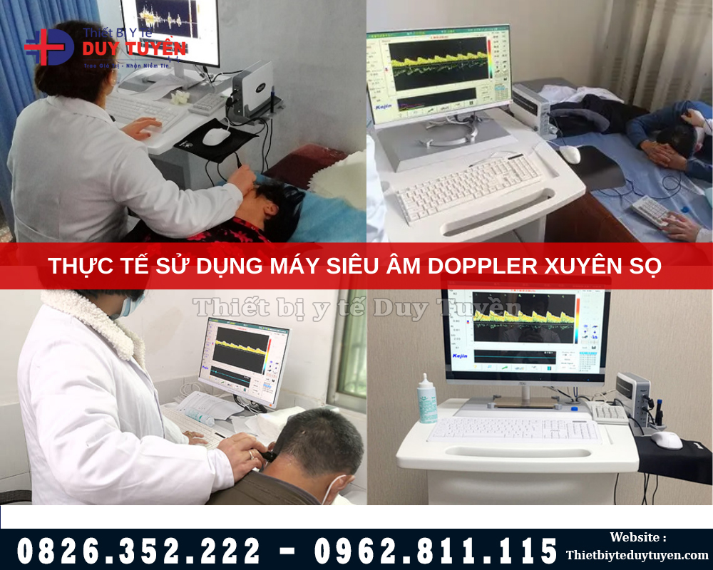máy siêu âm xuyên sọ di động TCD