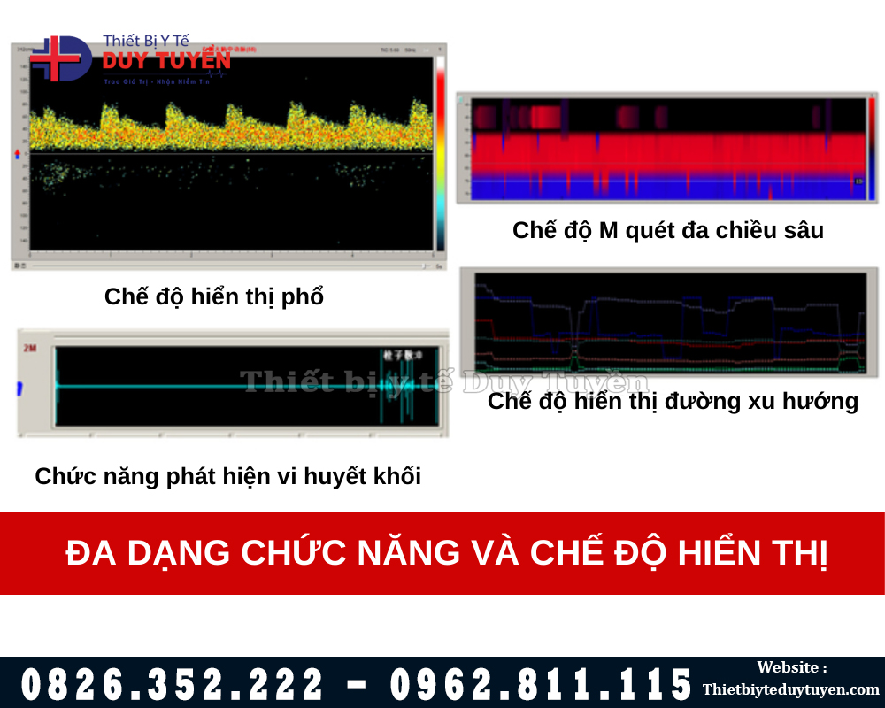 phần mềm kết quả máy đo lưu huyết não