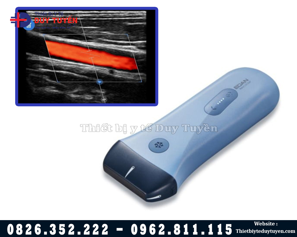 máy siêu âm cầm tay mini