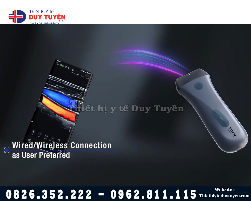 công nghệ máy siêu âm cầm tay edan l12 