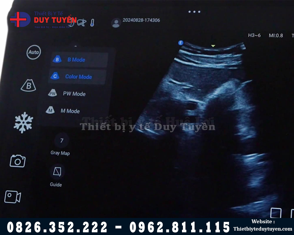 hình ảnh thực tế máy siêu âm edan l12