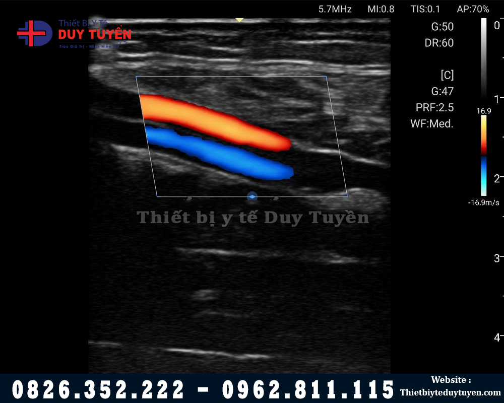 máy siêu âm edan l12 giá rẻ