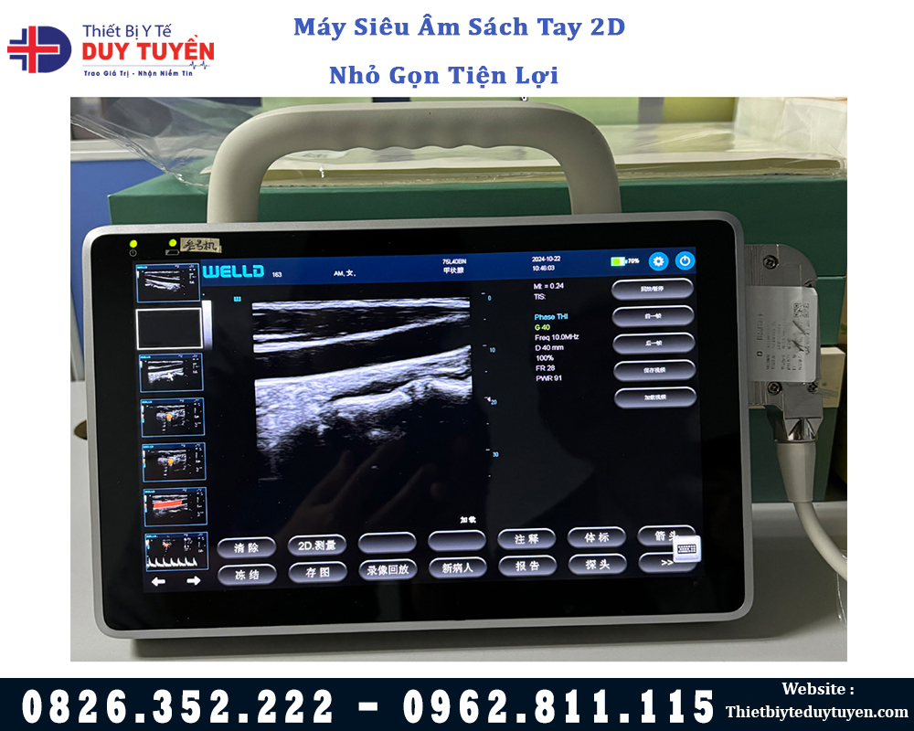 máy siêu âm sách tay nhỏ gọn khi đem đi xa