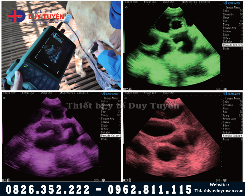 hình ảnh siêu âm thai lợn