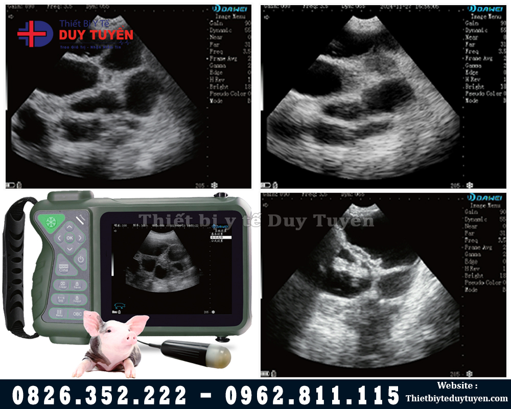 máy siêu âm thai cho lợn di động