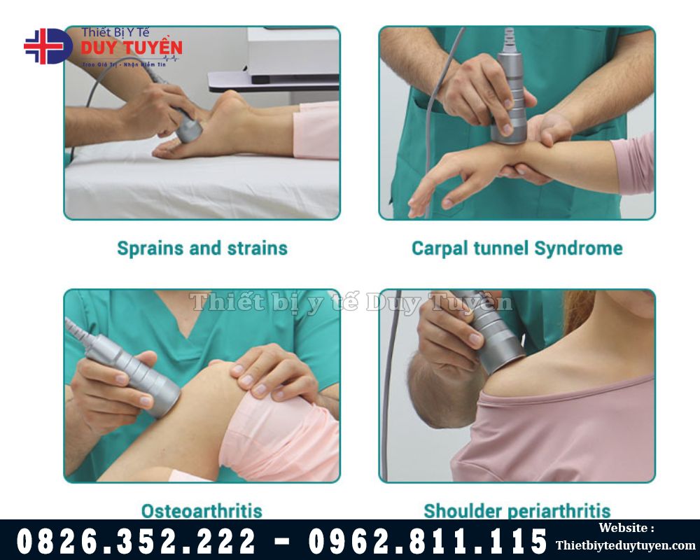 Hiệu quả máy siêu âm trị liệu