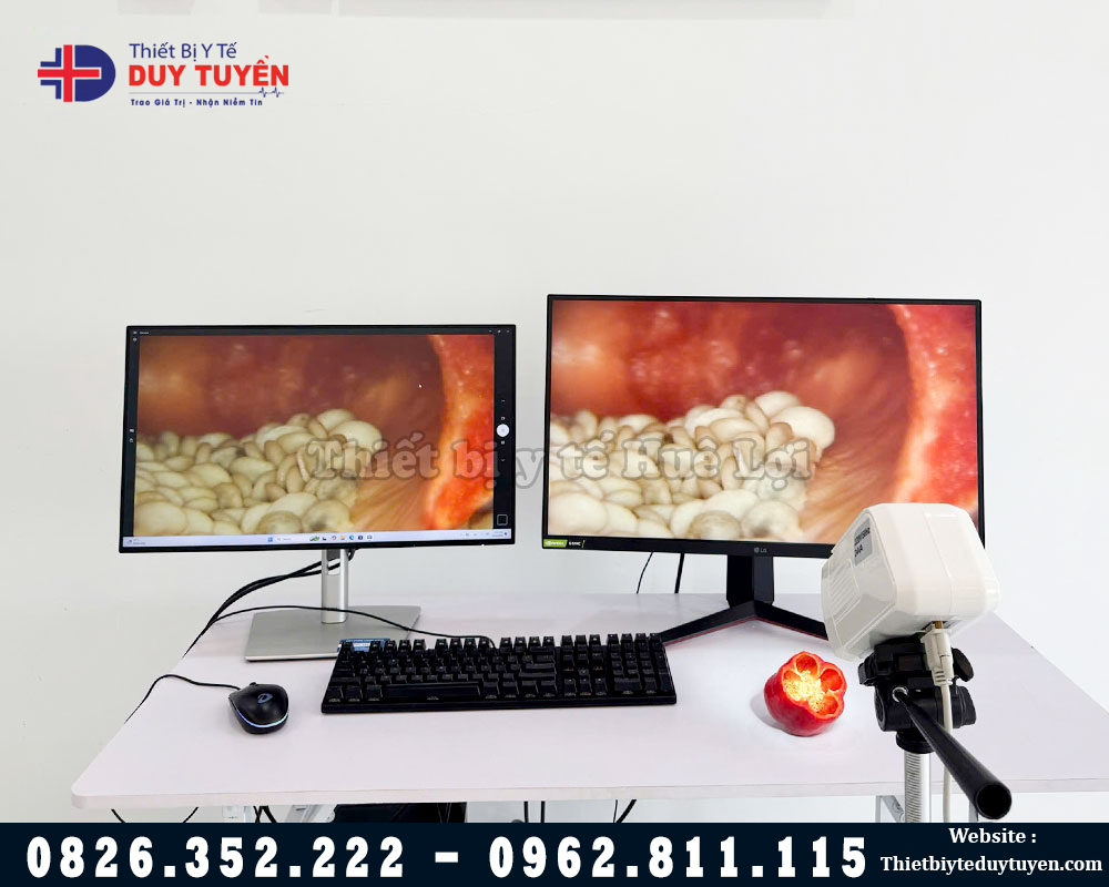 chất lượng hình ảnh máy soi tử cung