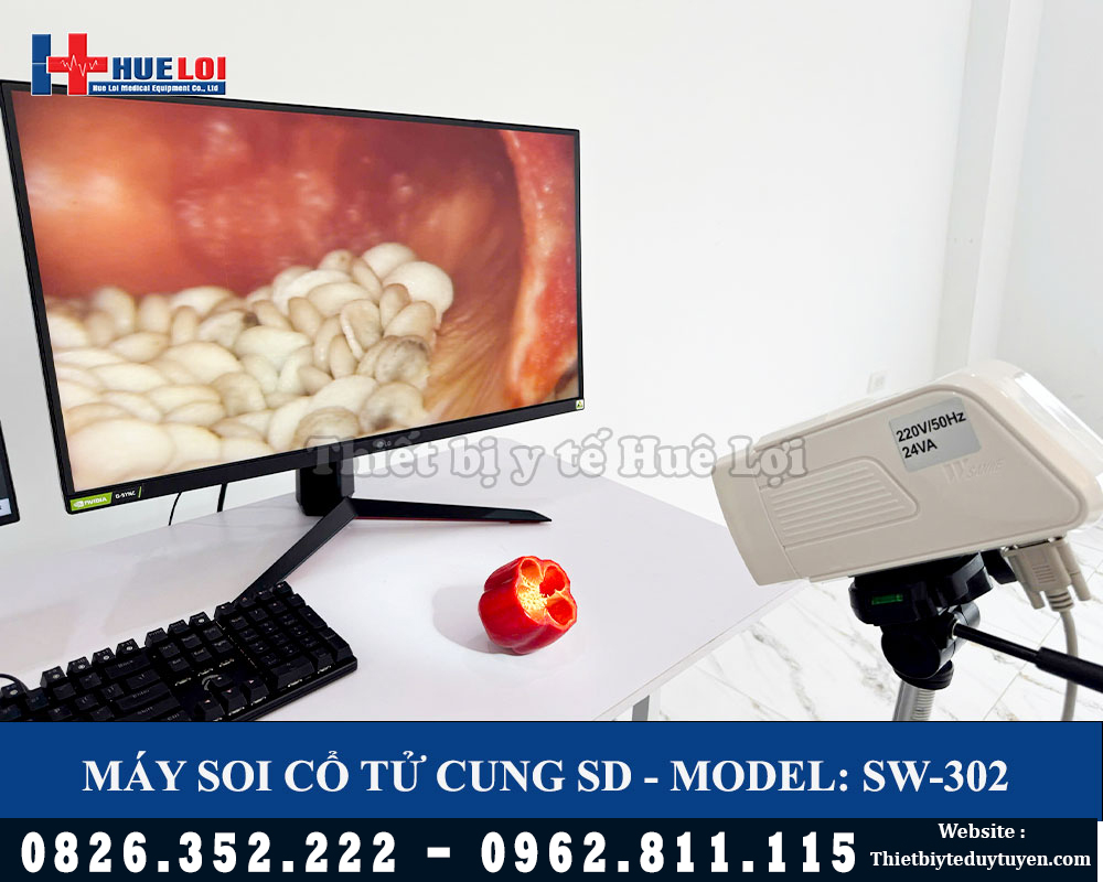 máy soi tử cung chất lượng SD