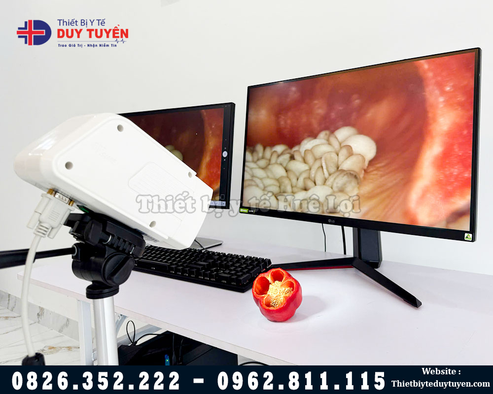 soi tử cung giá rẻ chất lượng SD