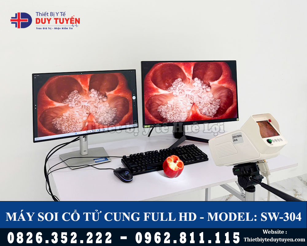 chất lượng hình ảnh máy soi tử cung HD