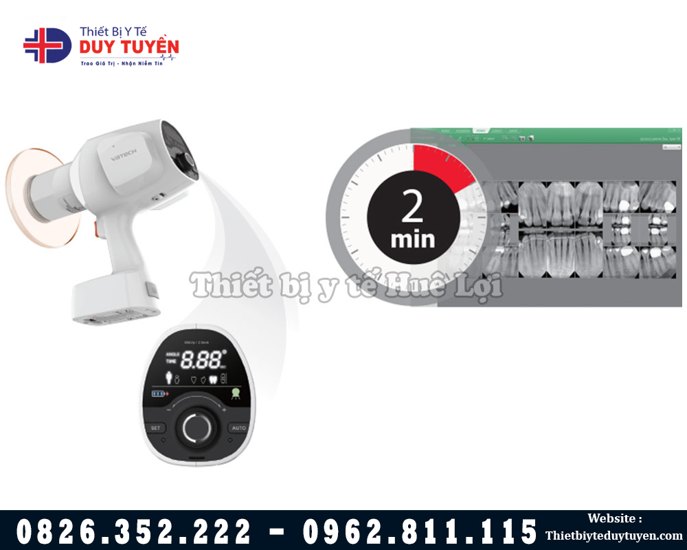 Vatech X Quang Nha khoa di động