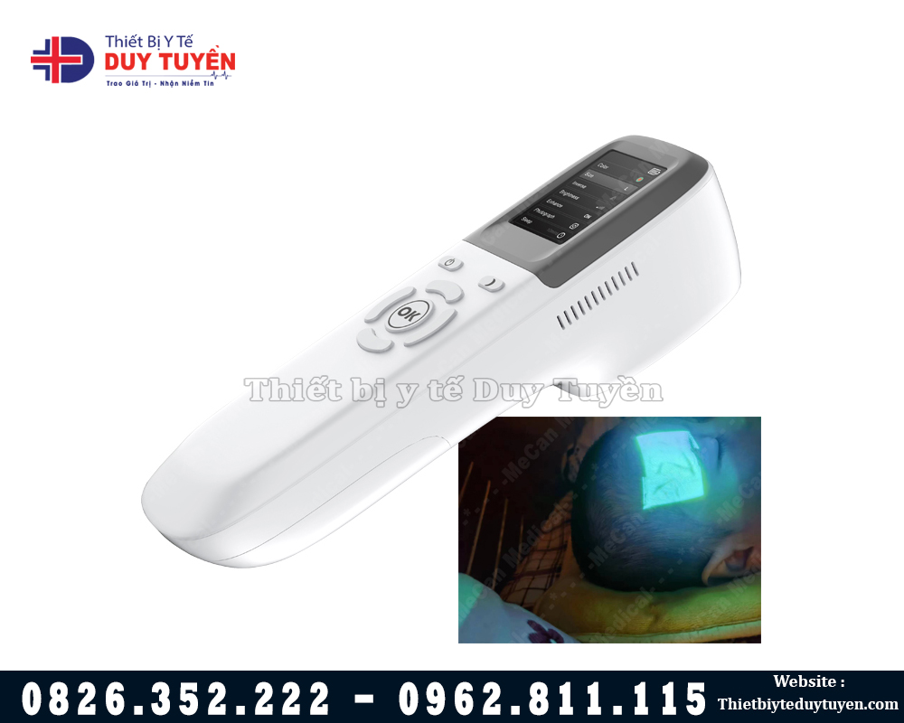 máy soi tĩnh mạch cầm tay